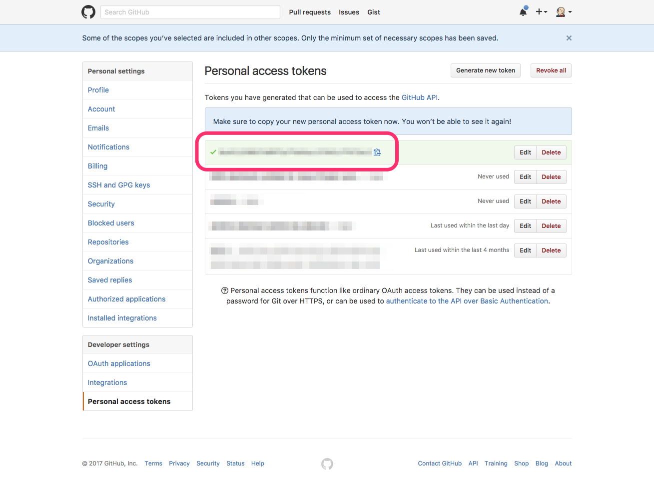 Aws Lambda で Github の Projects 機能を Issue と連動させて Trello の代替とする Qiita