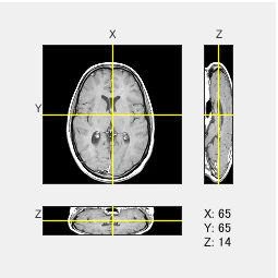 figure_18.png