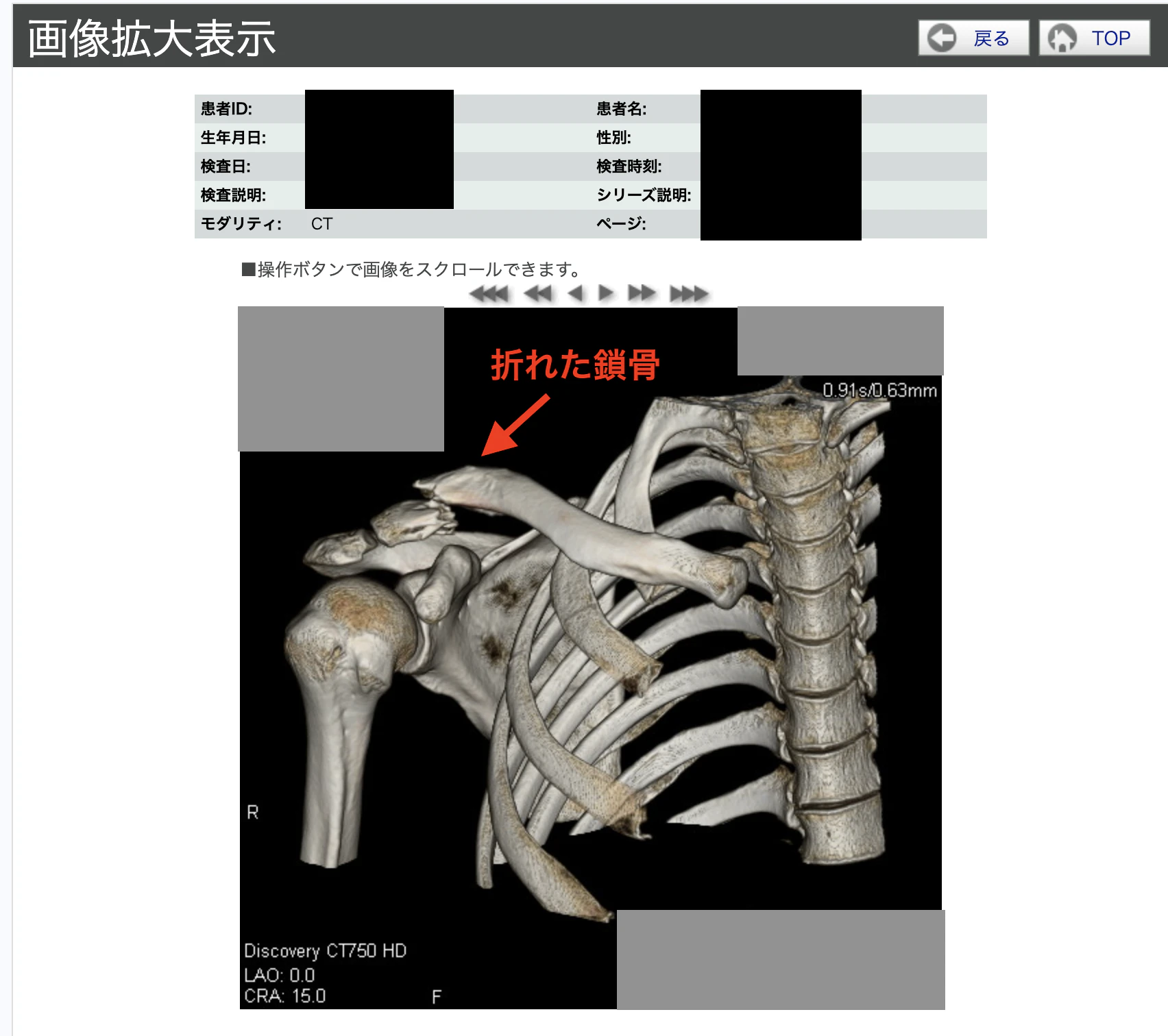 簡易ビュワーでの表示.png