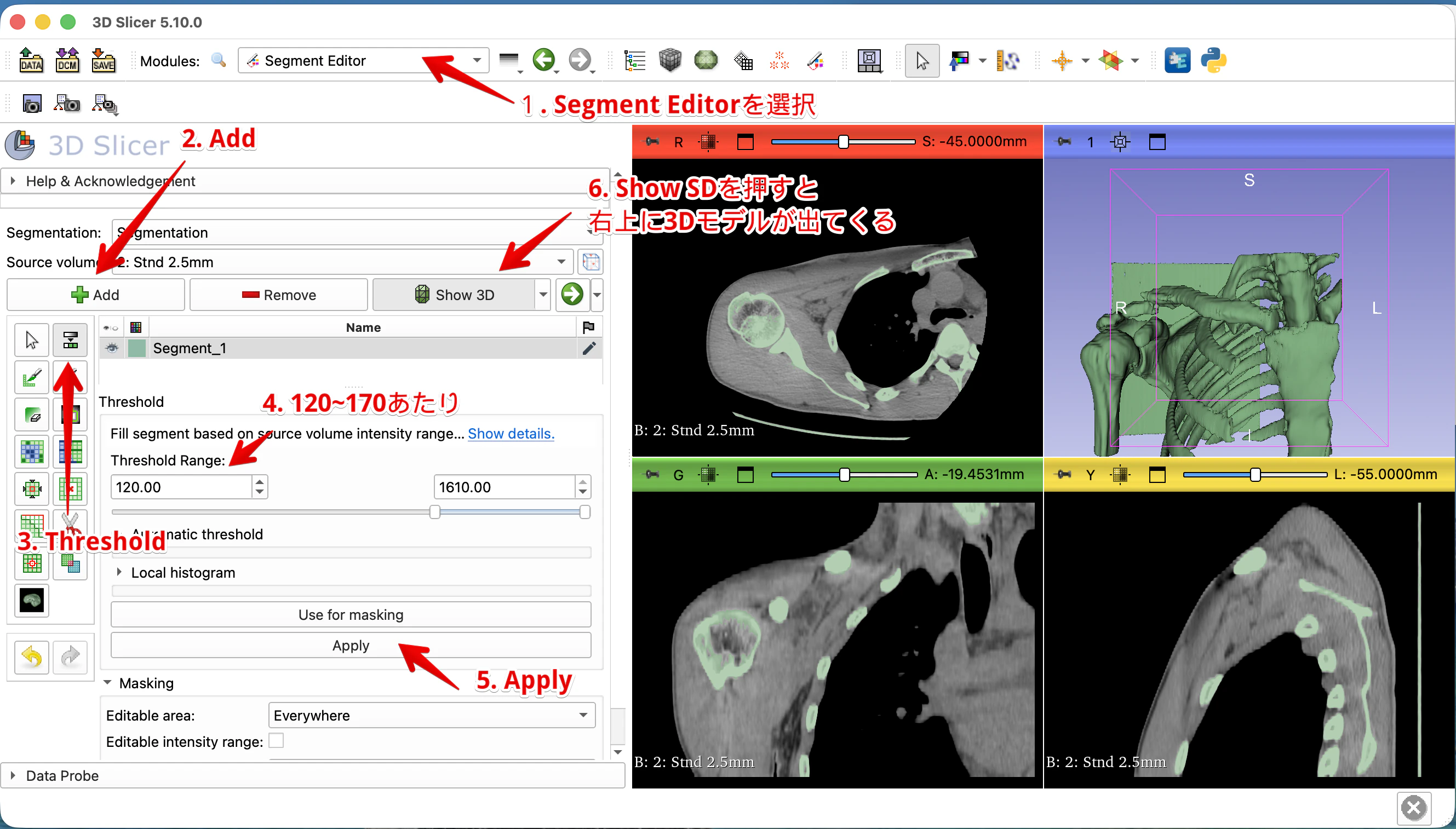 3D_Slicer_Segment_Editor.png