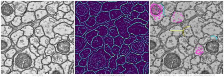A Second Opinion for EM Connectome Proofreading — Membranes Belong Only on Label Boundaries